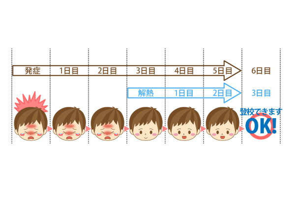 小学生以上のインフルエンザ発症から出席停止期間の事例①